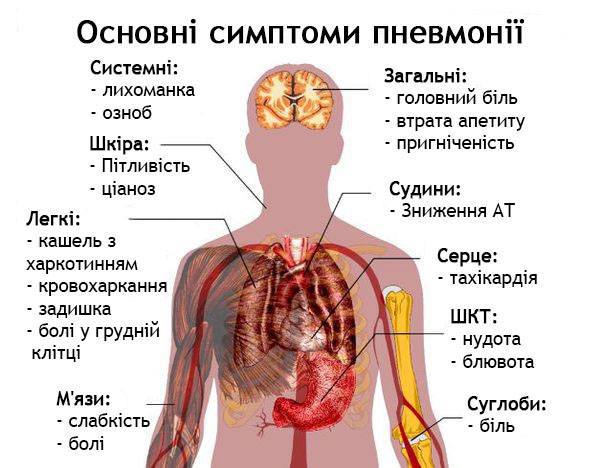 Вспышка пневмонии во Львовской области